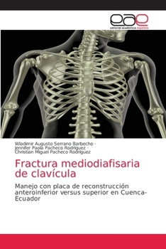 Paperback Fractura mediodiafisaria de clavícula [Spanish] Book