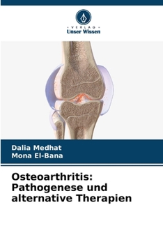 Paperback Osteoarthritis: Pathogenese und alternative Therapien [German] Book