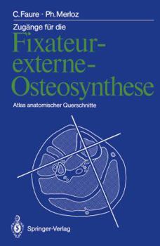 Paperback Zugänge Für Die Fixateur-Externe-Osteosynthese: Atlas Anatomischer Querschnitte [German] Book
