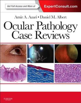 Paperback Ocular Pathology Case Reviews: Expert Consult - Online and Print Book