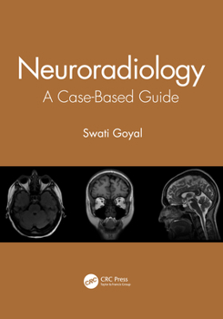 Paperback Neuroradiology: A Case-Based Guide Book