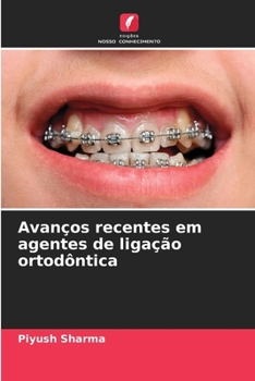 Paperback Avanços recentes em agentes de ligação ortodôntica [Portuguese] Book