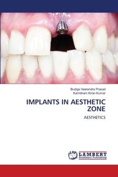 Paperback Implants in Aesthetic Zone Book
