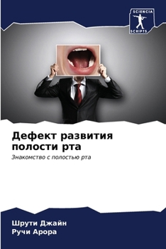 Paperback Дефект развития полости [Russian] Book