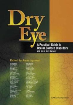 Hardcover Dry Eye: A Practical Guide to Ocular Surface Disorders and Stem Cell Surgery Book