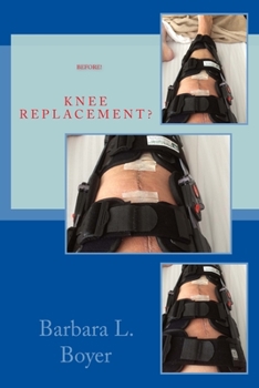 Paperback Read This BEFORE Your Knee Replacement Book
