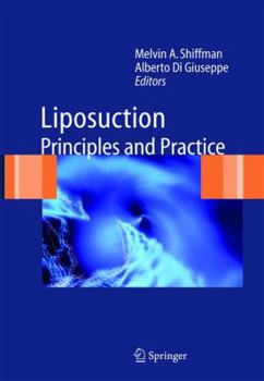 Paperback Liposuction: Principles and Practice Book