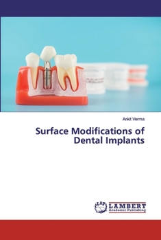 Paperback Surface Modifications of Dental Implants Book