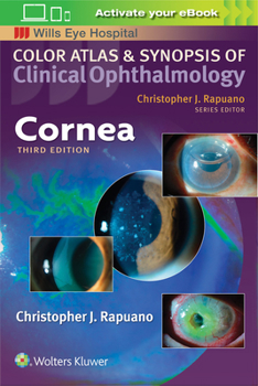 Paperback Cornea Book