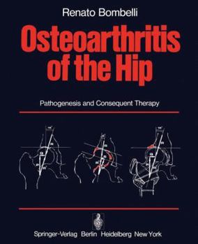 Hardcover Osteoarthritis of the Hip: Pathogenesis and Consequent Therapy Book