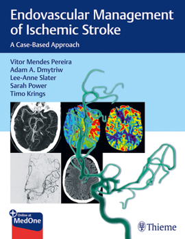 Paperback Endovascular Management of Ischemic Stroke: A Case-Based Approach Book