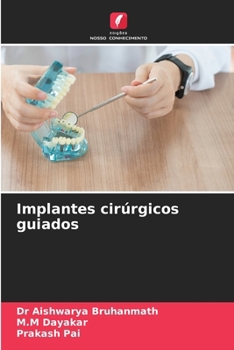 Implantes cirúrgicos guiados
