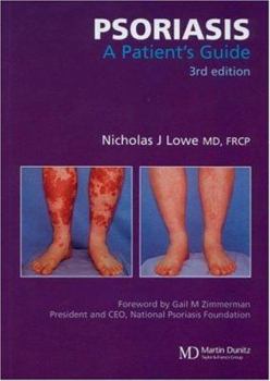 Paperback Psoriasis: A Patient's Guide, Third Edition Book
