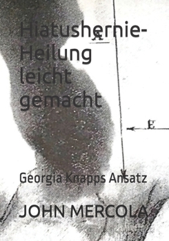 Paperback Hiatushernie-Heilung leicht gemacht: Georgia Knapps Ansatz [German] Book