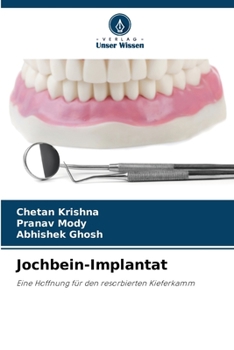 Paperback Jochbein-Implantat [German] Book