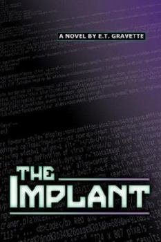 Paperback The Implant Book