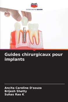 Paperback Guides chirurgicaux pour implants [French] Book