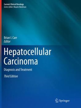Paperback Hepatocellular Carcinoma: Diagnosis and Treatment Book