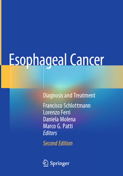 Esophageal Cancer: Diagnosis and Treatment