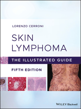 Hardcover Skin Lymphoma Book