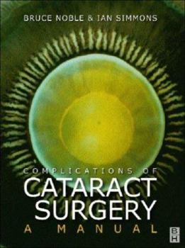 Hardcover Complications of Cataract Surgery: A Manual Book