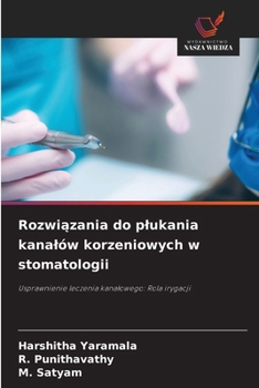 Paperback Rozwi&#261;zania do plukania kanalów korzeniowych w stomatologii [Polish] Book