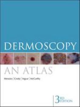 Paperback Dermoscopy: An Atlas 3e Book