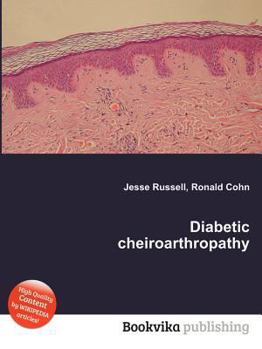 Paperback Diabetic Cheiroarthropathy Book