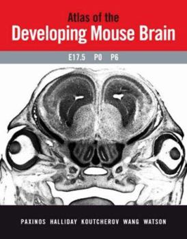 Spiral-bound Atlas of the Developing Mouse Brain at E17.5, P0 and P6 [With CDROM] Book