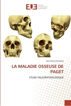 Paperback La maladie osseuse de paget [French] Book
