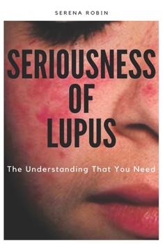 Paperback Seriousness of Lupus: The Understanding That You Need Book
