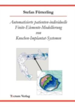 Paperback Automatisierte patienten-individuelle Finite-Elemente-Modellierung von Knochen-Implantat-Systemen Book