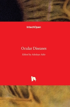 Hardcover Ocular Diseases Book