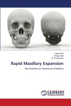 Paperback Rapid Maxillary Expansion Book