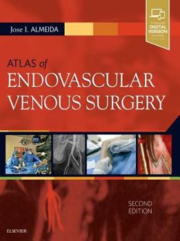 Hardcover Atlas of Endovascular Venous Surgery Book