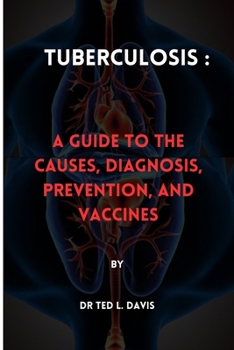 Paperback Tuberculosis: : A Guide to the Causes, Diagnosis, Prevention, and Vaccines Book