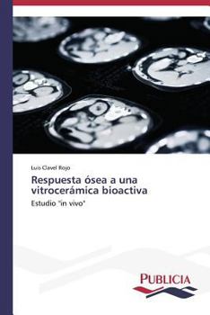Paperback Respuesta ósea a una vitrocerámica bioactiva [Spanish] Book