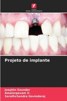 Paperback Projeto de implante [Portuguese] Book