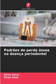 Paperback Padrões de perda óssea na doença periodontal [Portuguese] Book
