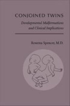 Hardcover Conjoined Twins: Developmental Malformations and Clinical Implications Book