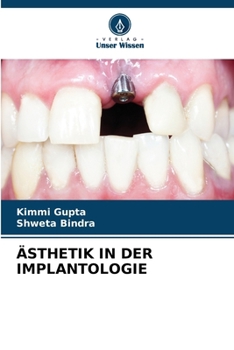 Ästhetik in Der Implantologie (German Edition)
