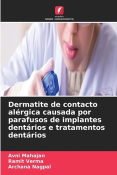 Dermatite de contacto alérgica causada por parafusos de implantes dentários e tratamentos dentários (Portuguese Edition)