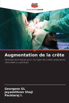 Paperback Augmentation de la crête [French] Book