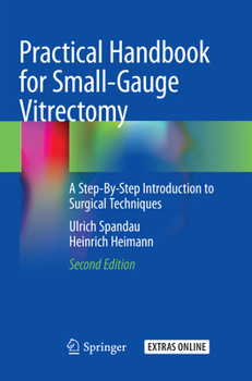 Paperback Practical Handbook for Small-Gauge Vitrectomy: A Step-By-Step Introduction to Surgical Techniques Book