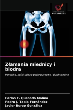 Złamania miednicy i biodra: Panewka, kości udowe podkrętarzowe i diaphysealne