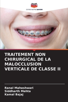 Paperback Traitement Non Chirurgical de la Malocclusion Verticale de Classe II [French] Book