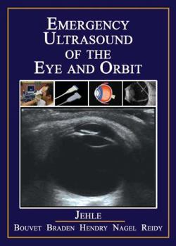 Paperback Emergency Ultrasound of the Eye and Orbit Book