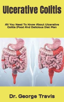 Ulcerative Colitis: All You Need To Know About Ulcerative Colitis (Food And Delicious Diet Plan