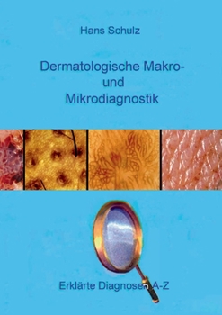 Paperback Dermatologische Makro- und Mikrodiagnostik: Erklärte Diagnosen A-Z [German] Book