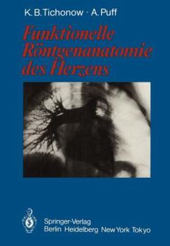 Paperback Funktionelle Röntgenanatomie Des Herzens [German] Book